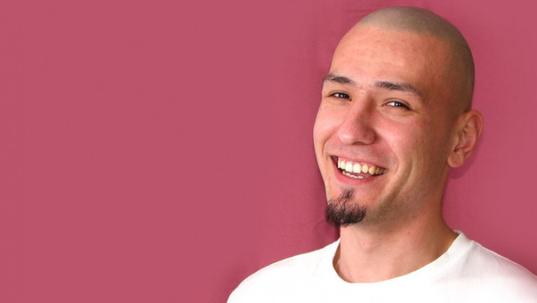 Bald Scalp Calls for SMP Treatment by Hair Replication Studio