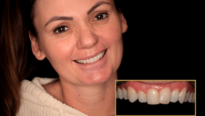 Best Cosmetic Dentist in Australia