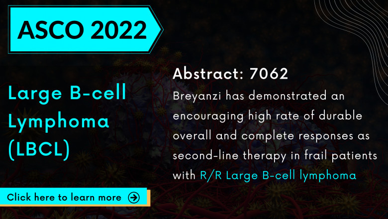 Can Breyanzi be a hit CAR-T in second-line treatment after failing in the first-line setting for the patients with R/R Large B-cell lymphoma (LBCL)?