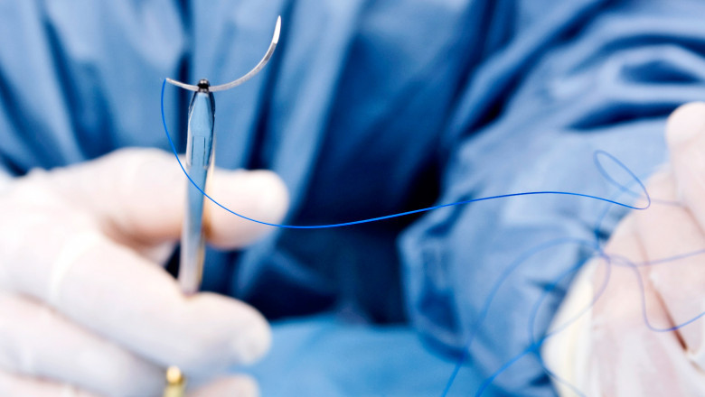 Suture Needles Market Research Report Detailed Analysis 2022| Research Informatic