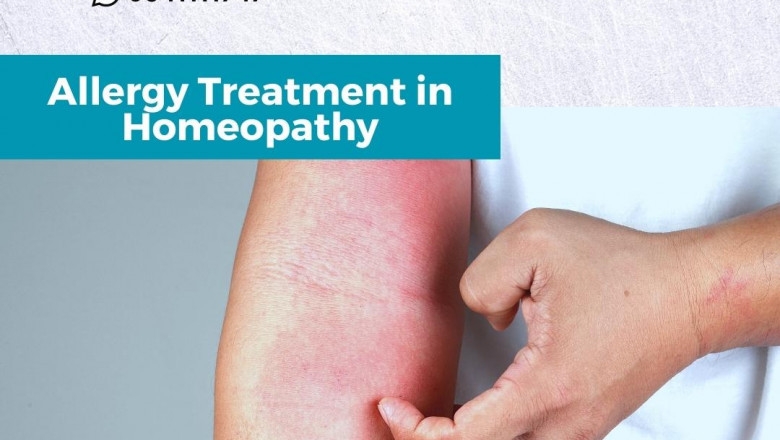Allergy Treatment in Homeopathy for The best Results