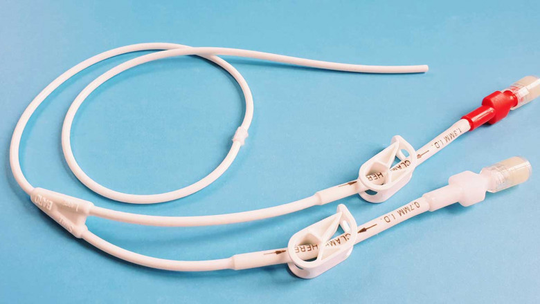 Global and Chinese catheters market are likely to be hindered by high cardiac catheterization costs