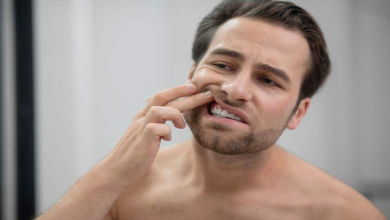 Most Common Culprit’s Hitting Your Gums