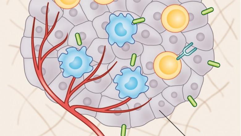 Tumor Infiltrating Lymphocytes Market Deep Analysis, Forecast period 2022-2027