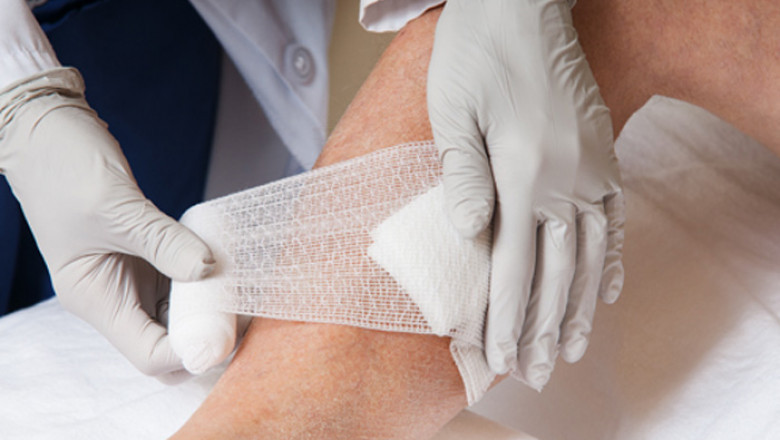 The Traditional Wound Management Market: Trends, Share, Size, Growth, Opportunities, and Forecast up to 2027