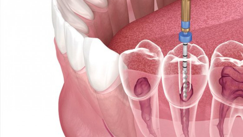 Cosmetic Dental Service in Sunrise FL - John F Largen