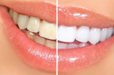 Excellent Benefits Of Cosmetic Dentistry: Tower House Dental Clinic