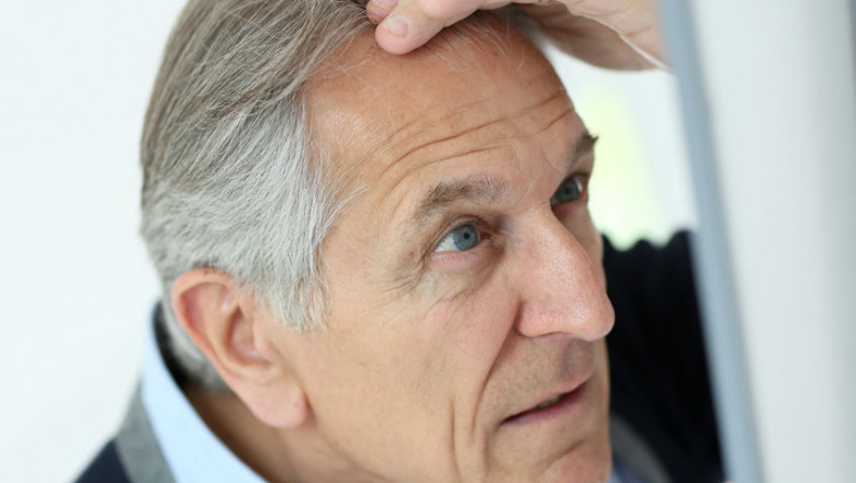 Haarausfall und Vitamine