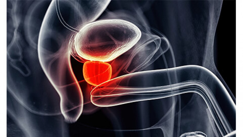 Prostatitis je problem s kojim se treba pozabaviti