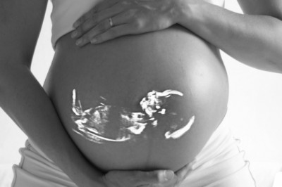 Some Important Things To Keep In Mind During Pregnancy