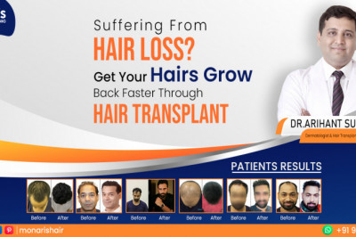 Hair Transplant in Indore - Monaris Hair Clinic