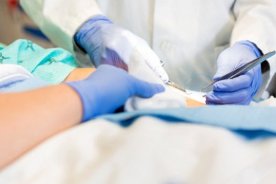 Post-Operative Surgical Wound Care - Essential Tips