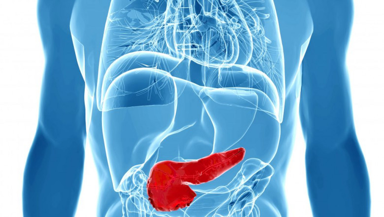 Bone marrow is transplanted during Gaucher disease treatment