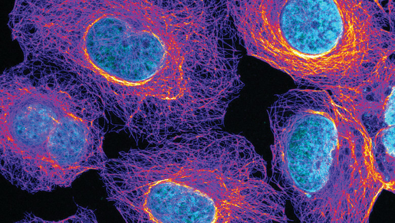 By Using Life Cell Imaging, One Can Better Understand How Molecules Interact And Assemble Dynamically