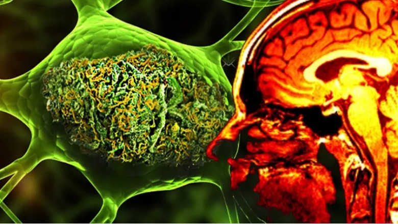 It Is Possible To Manage Some Symptoms Of Huntington's Disease Treatment With The Help Of Drugs, Physical Therapy, And Speech Therapy