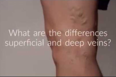 The Difference Between Superficial and Deep Veins