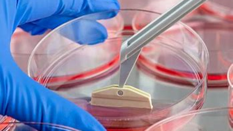 Cell Therapy Biomanufacturing Market 2022 | Industry Demand, Fastest Growth, Opportunities Analysis and Forecast To 2028