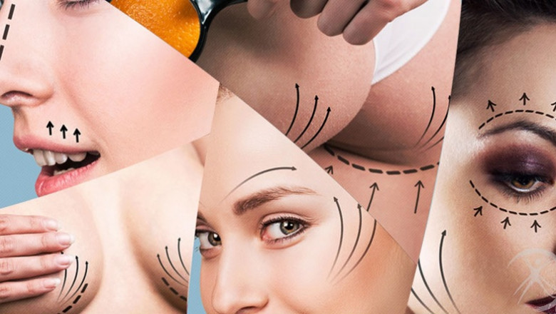 What are the reasons for cosmetic surgery?