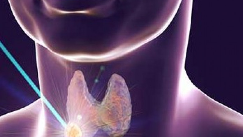 Thyroid Cancer Market Analysis Insights by Latest Trends, Future Growth, Revenue and Demand