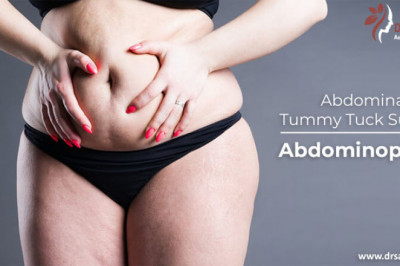Abdominoplasty: when is it indicated and how is the surgery performed?