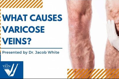 What Causes Varicose Veins? by Dr. Jacob White [WEBINAR]