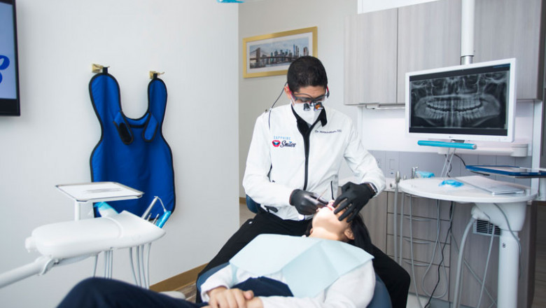 What Are Veneers?