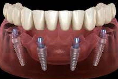 What May New Dentures Feel Like?