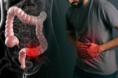 Top Herbal Medicine - Natural Constpation Medicine For Seena?