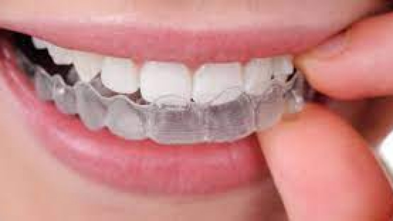 5 Concerns to Ask Before You Select a World-class Cosmetic Dentist