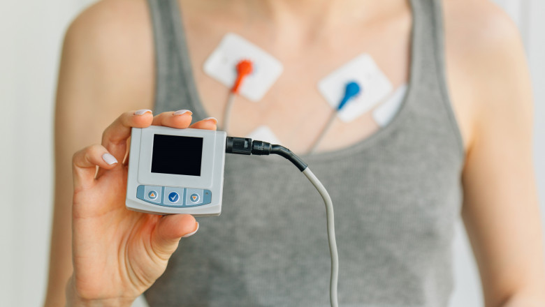 A device that records the electrical activity of the heart; cardiac monitoring devices