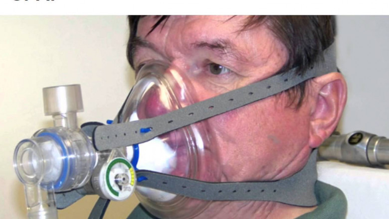 Neonatal Respiratory Distress Syndrome Treatment Market Outlook