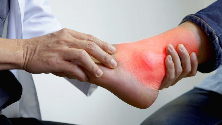 North America Global Gout Disease Treatment Market Drivers