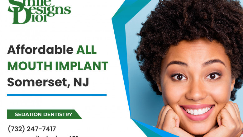 Why sedation dentistry is the best way to get dental implants?