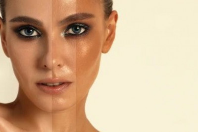 Best Body Lotion For Dry Skin And Glowing Skin