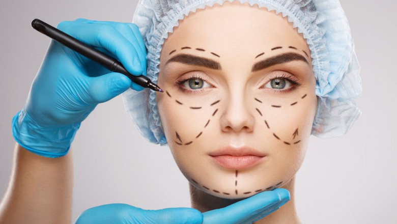 Everything you need to know before taking face upliftment surgery