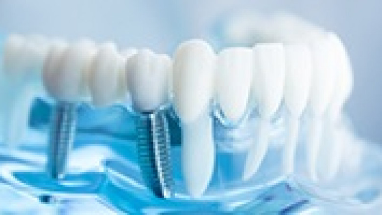 Future | Growth and Emerging Trends in Dental Biomaterials Market