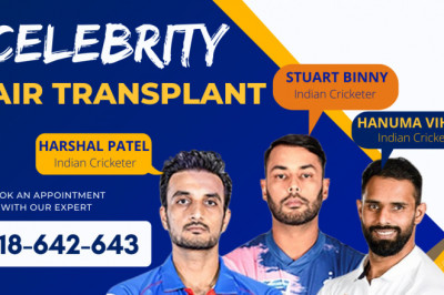 Hair Transplant in Delhi at monaris hair clinic