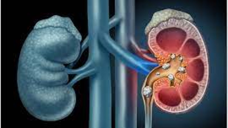 Cystinuria Treatment Market 2022 Major Key Players and Industry Analysis Till 2028