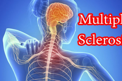Multiple Sclerosis Therapeutics, physical therapy, and rehabilitation are all part of MS Therapeutics