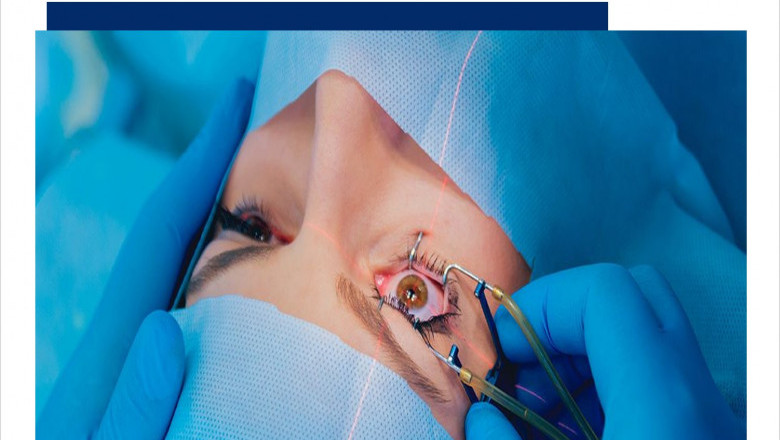 Asia Pacific (APAC) Lasik Surgery Market (2019-2025) | Trend