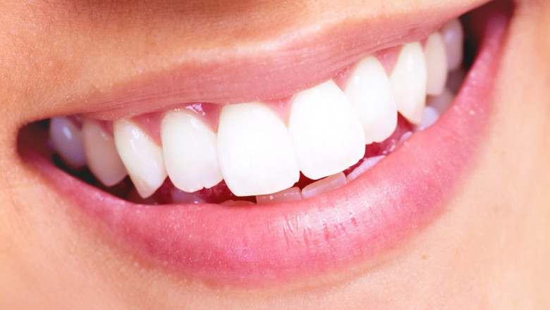 What Are The Different Types Of Teeth Whitening Methods?