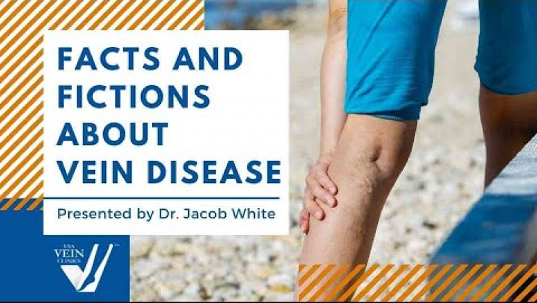 Facts and Fictions About Vein Disease