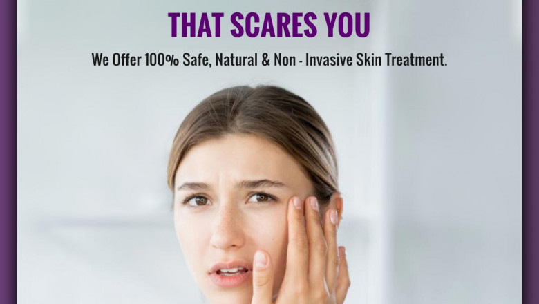 Things to Consider When Choosing the Right Dermatologist in Bangalore That Fits You and Your Budget