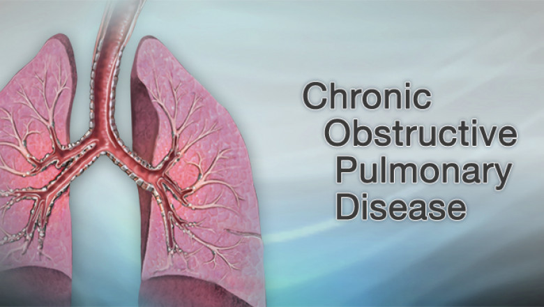 Chronic Obstructive Pulmonary Disease (COPD) Treatment Market Size, Key Players Analysis And Forecast To 2028 | Value Market Research