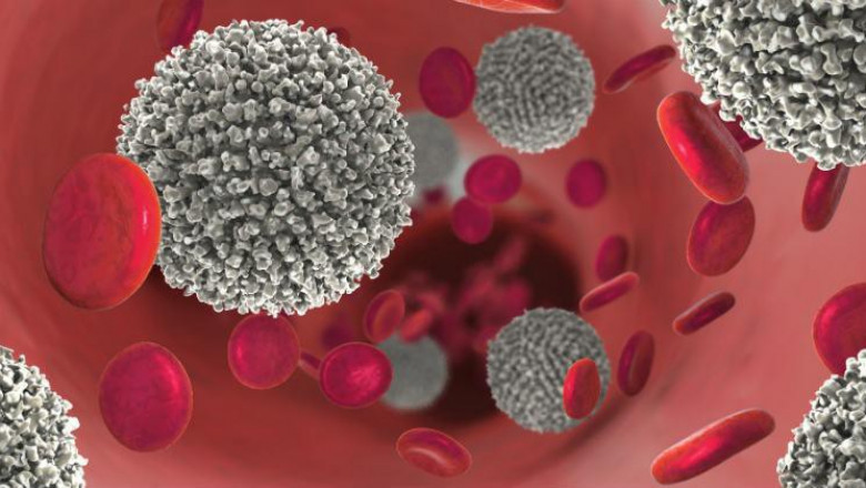 Global Leukemia Therapeutics Market Restraints