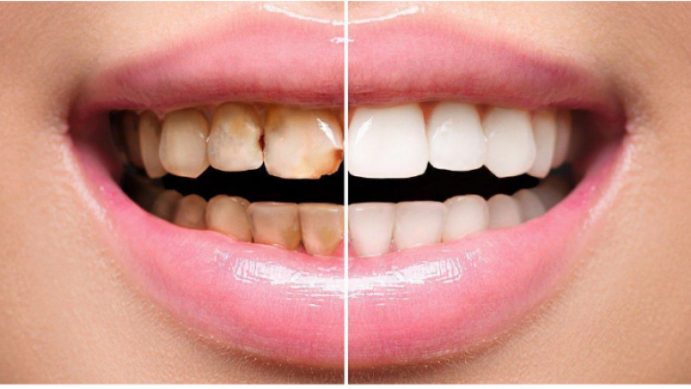 Wish To Change Your Smile From Dull To Dazzling 1