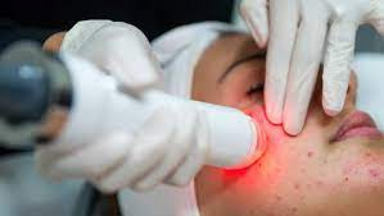 Non-Invasive Aesthetic Treatment Market Size, Status, Growth | Industry Analysis Report 2020-2028