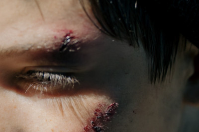 Top 5 Questions to Ask a slip and fall injury lawyer