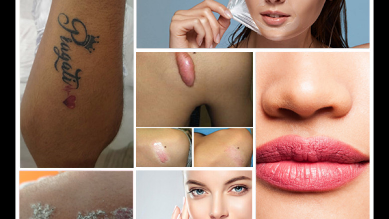 HLCCS Skin & Laser Center
