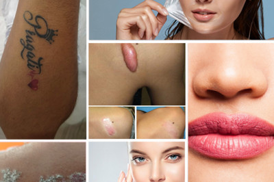 HLCCS Skin & Laser Center